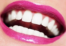 For beautiful white teeth is not difficult